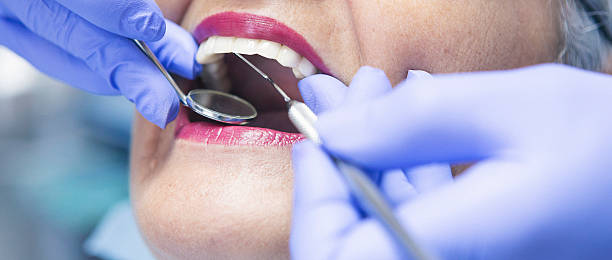 Best Emergency Dental Care for Broken or Chipped Teeth in Short Hills, NJ